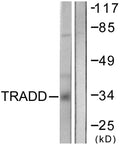 Anti-TRADD antibody (251-300 aa) (STJ96081) – Figure 1 of 1