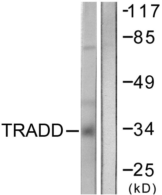 Anti-TRADD antibody (251-300 aa) (STJ96081) – Figure 1 of 1