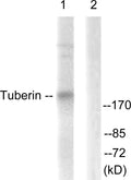 Anti-TSC2 antibody (905-954 aa) (STJ96139) – Figure 1 of 1