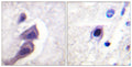 Anti-TSC2 antibody (1428-1477 aa) (STJ96140) – Figure 1 of 1