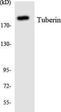 Anti-TSC2 antibody (947-996 aa) (STJ96141) – Figure 1 of 1