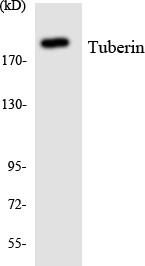 Anti-TSC2 antibody (947-996 aa) (STJ96141) – Figure 1 of 1
