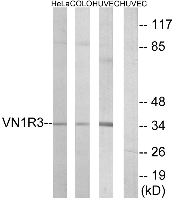 Anti-VN1R3 antibody (129-178 aa) (STJ96213) – Figure 1 of 1