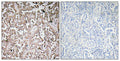Anti-VAMP-1/2/3 antibody (21-70 aa) (STJ96215) – Figure 1 of 1