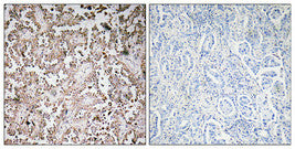 Anti-VAMP-1/2/3 antibody (21-70 aa) (STJ96215) – Figure 1 of 1