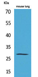 Anti-CMA1 antibody (Internal) (STJ96488) – Figure 1 of 1