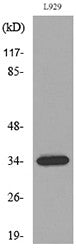Anti-OGN antibody (231-280 aa) (STJ96659) – Figure 1 of 1