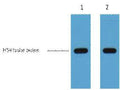 Anti-HSV-Tag antibody [9D7] (STJ96916) – Figure 1 of 1