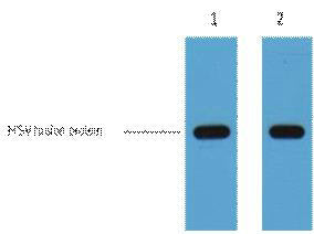 Anti-HSV-Tag antibody [9D7] (STJ96916) – Figure 1 of 1