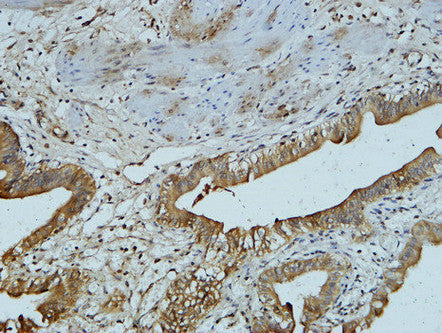 Anti-AFP antibody [17C5] (STJ96977) – Figure 1 of 1