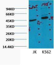 Anti-CD16 antibody [Q32] (STJ96992) – Figure 1 of 1