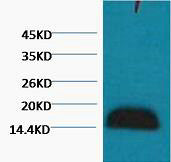 Anti-Histone H3 antibody (STJ97022) – Figure 1 of 1