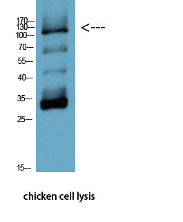Anti-PARP1 antibody [M3] (STJ97033) – Figure 1 of 1