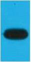 Anti-mOrange-Tag antibody [Mix] (STJ97073) – Figure 1 of 1