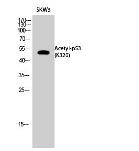 Anti-Acetyl-TP53-Lys320 antibody (STJ97359) – Figure 1 of 1