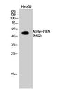 Anti-Acetyl-PTEN-Lys402 antibody (STJ97361) – Figure 1 of 1