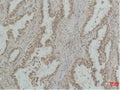Anti-Mono-Methyl-TP53-Q59 antibody [Q59] (STJ97495) – Figure 1 of 1