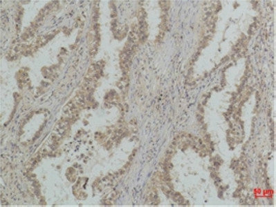 Anti-Mono-Methyl-TP53-Q59 antibody [Q59] (STJ97495) – Figure 1 of 1