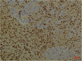 Anti-ARNT antibody [4C5] (STJ97602) – Figure 1 of 1