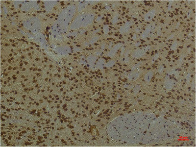 Anti-ARNT antibody [4C5] (STJ97602) – Figure 1 of 1