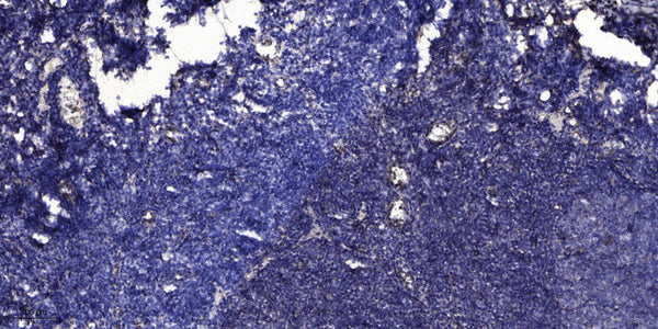 Anti-TF antibody [2D7] (STJ97610) – Figure 1 of 1