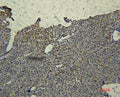 Anti-TF antibody [2F2] (STJ97611) – Figure 1 of 1