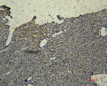Anti-TF antibody [2F2] (STJ97611) – Figure 1 of 1