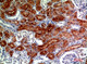 Anti-DROSHA antibody (774-823 aa) (STJ97614) – Figure 1 of 1
