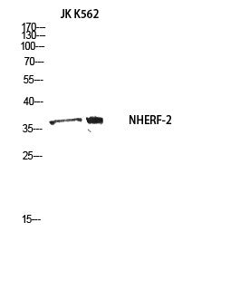 Anti-NHERF2 antibody (20-100 aa) (STJ97629) – Figure 1 of 1
