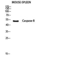 Anti-Cleaved-CASP8-S217 antibody (170-250 aa) (STJ97641) – Figure 1 of 1