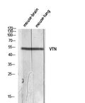 Anti-VTN antibody (50-100 aa) (STJ97659) – Figure 1 of 1
