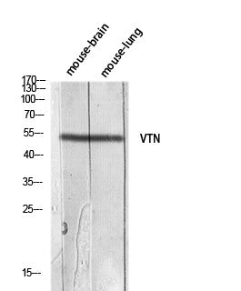 Anti-VTN antibody (50-100 aa) (STJ97659) – Figure 1 of 1