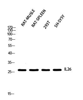 Anti-IL26 antibody (21-70 aa) (STJ97676) – Figure 1 of 1