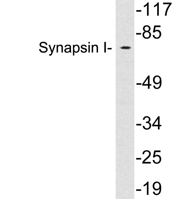 Anti-SYN1 antibody (Internal) (STJ97690) – Figure 1 of 1