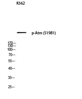 Anti-Phospho-ATM-Ser1981 antibody (STJ97691) – Figure 1 of 1