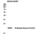 Anti-Di-Methyl-Histone H3.1-Lys27 antibody (STJ97693) – Figure 1 of 1