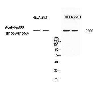 Anti-Acetyl-EP300-Lys1560 antibody (STJ97697) – Figure 1 of 1