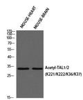 Anti-Acetyl-TAL1-Lys37 antibody (STJ97700) – Figure 1 of 1