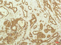 Anti-RPS6KB1 antibody [1C7] (STJ97708) – Figure 1 of 1