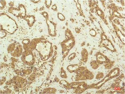 Anti-RPS6KB1 antibody [1C7] (STJ97708) – Figure 1 of 1
