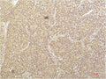 Anti-SGK1 antibody (350-430 aa) [4D12] (STJ97721) – Figure 1 of 1