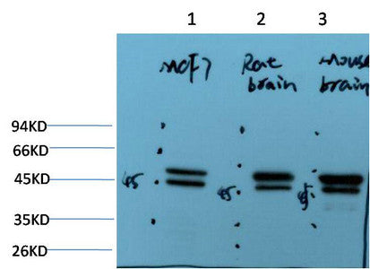 Anti-TUBE1 antibody [2B3] (STJ97760) – Figure 1 of 1