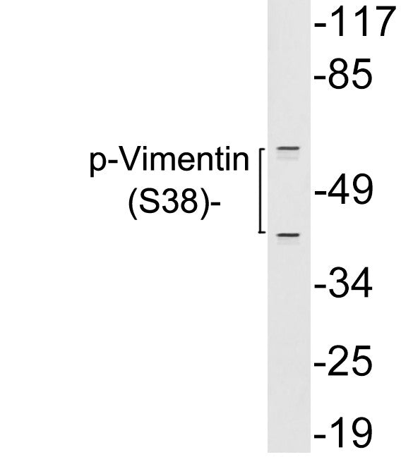 Anti-Phospho-VIM-Tyr38 antibody (STJ98572) – Figure 1 of 1