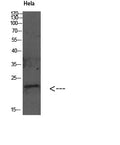 Anti-GABARAPL2 antibody (26-75 aa) (STJ98595) – Figure 1 of 1