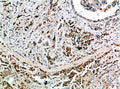 Anti-NANOS1 antibody (151-200 aa) (STJ98619) – Figure 1 of 1