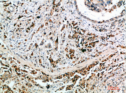 Anti-NANOS1 antibody (151-200 aa) (STJ98619) – Figure 1 of 1
