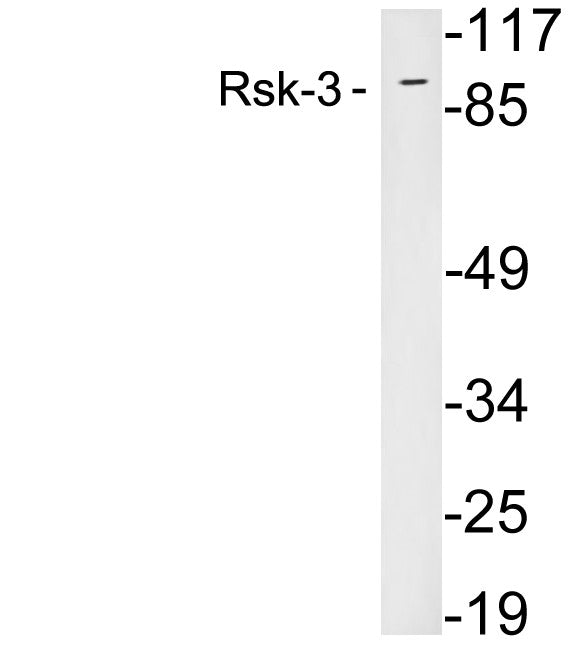 Anti-RPS6KA2 antibody (330-400 aa) (STJ98670) – Figure 1 of 1
