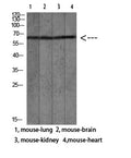 Anti-LGALS3BP antibody (100-160 aa) (STJ98720) – Figure 1 of 1