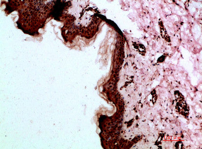Anti-DSG1 antibody (30-90 aa) (STJ98723) – Figure 1 of 1
