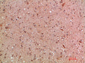 Anti-KMT2A antibody (3850-3900 aa) (STJ98732) – Figure 1 of 1